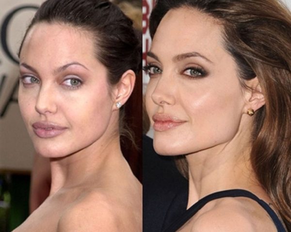 angelina-jolie-before-after-3