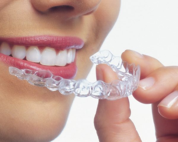 ventajas-invisalign3